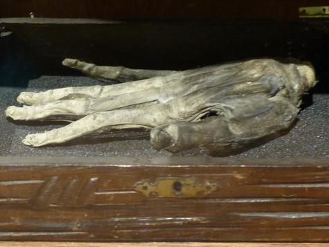 What Was A Supernatural ‘Hand Of Glory’ & How Did It Make Criminals So Powerful?